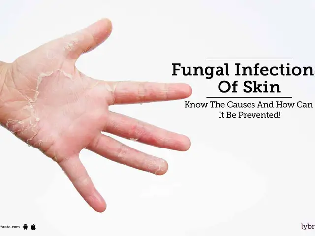 The Impact of Fungal Infections on Joint Health and Mobility